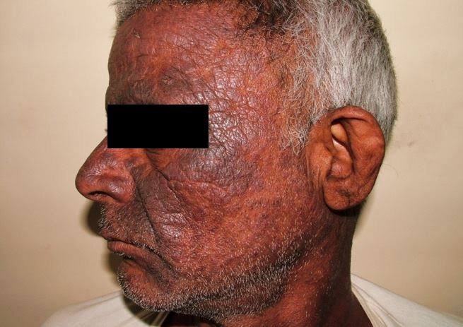 Vimla Skin Clinic